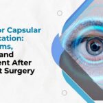 posterior capsular opacification